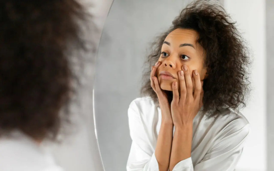 how to get rid of dark circles around eyes
