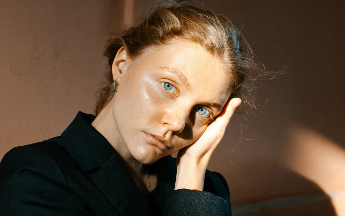 Redhead with problematic skin thinking of ways to manage her sensitive skin