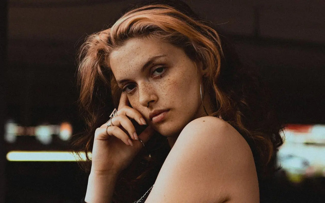 Do Freckles Need Special Skincare?