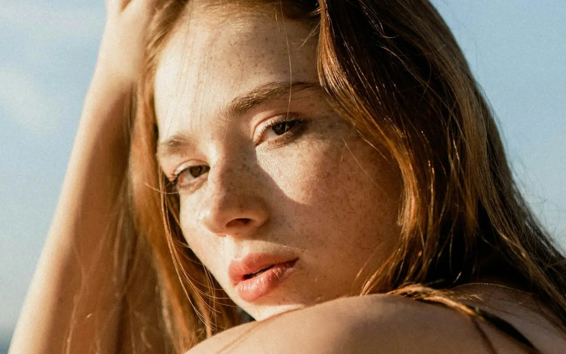 Young girl with sun freckles and hyperpigmentation on her skin, sunbathing on the beach