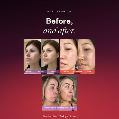 THE BESTSELLERS SET