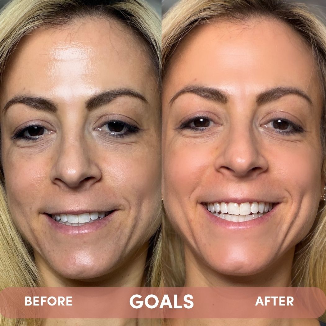 GOALS Multi Acids & Probiotics Perfecting Night Serum | PSA Skincare