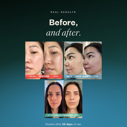 THE CLEAR SKIN SET
