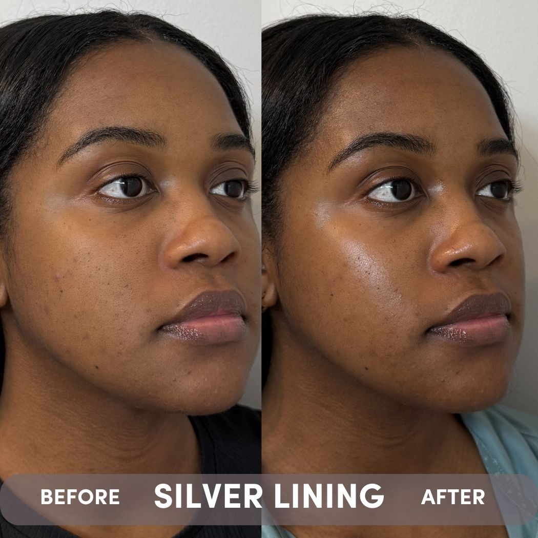ボディ・フェイスケア SILVER REED SILVER LINING Dioic & Willowherb Clarifying Cream | PSA Skincare